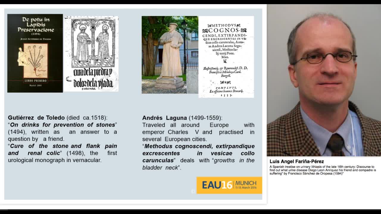 A Spanish treatise on urinary lithiasis of the late 16th -