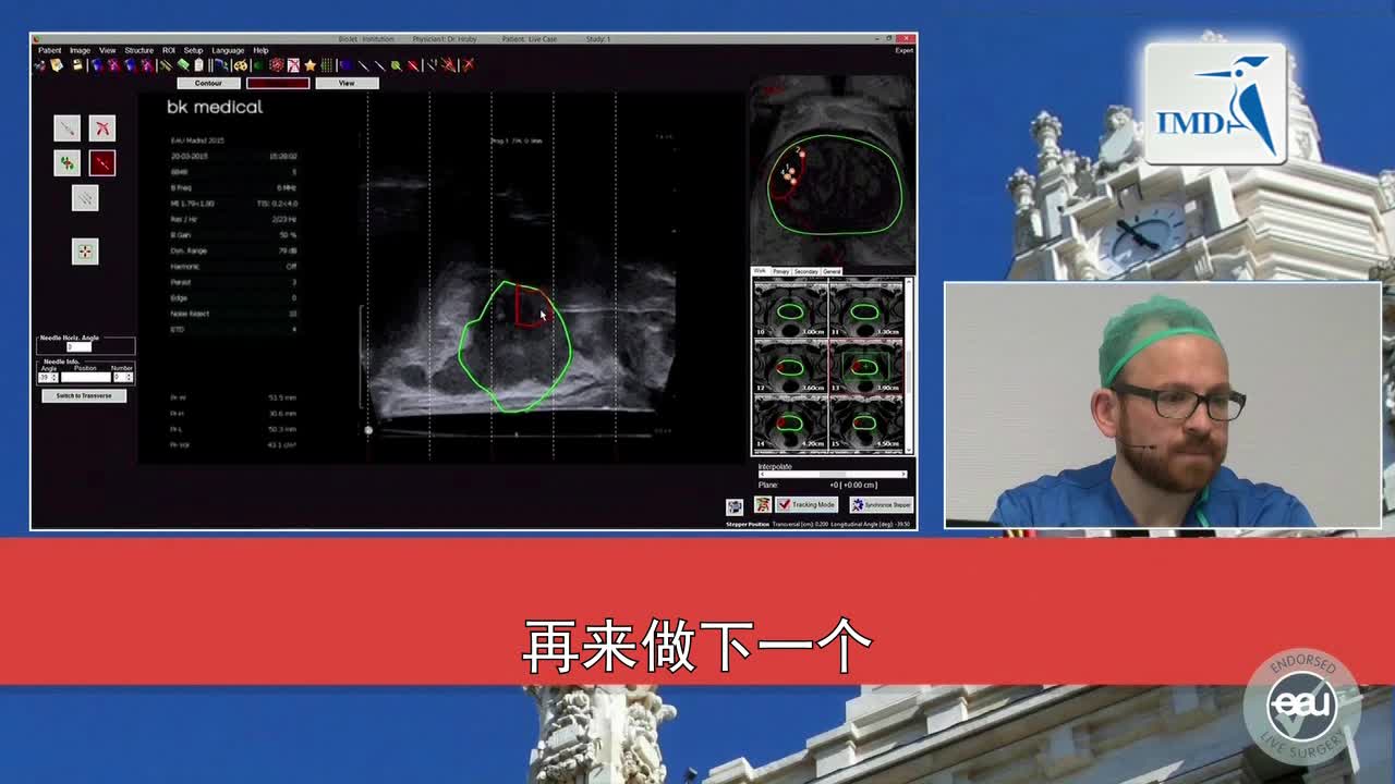 前列腺穿刺活检（2）