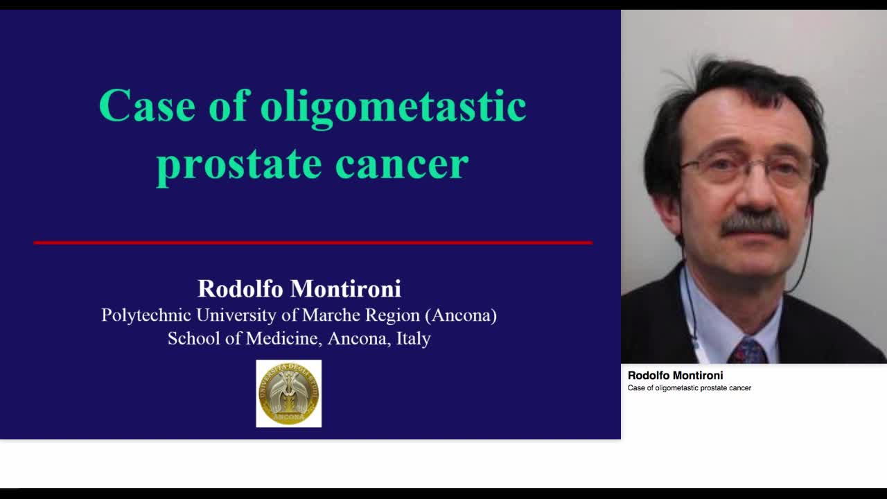 Case of oligometastic prostate cancer