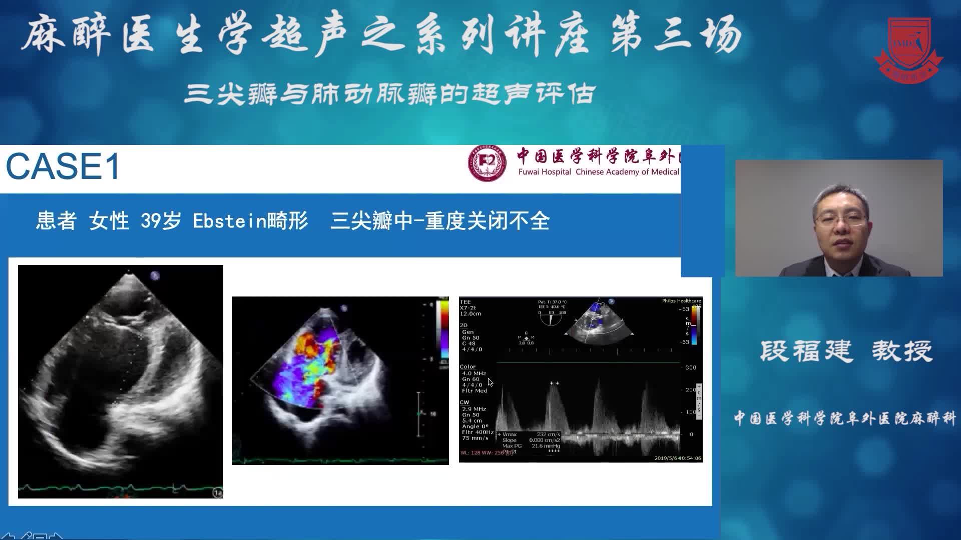 三尖瓣与肺动脉瓣的超声评估 段福建 03