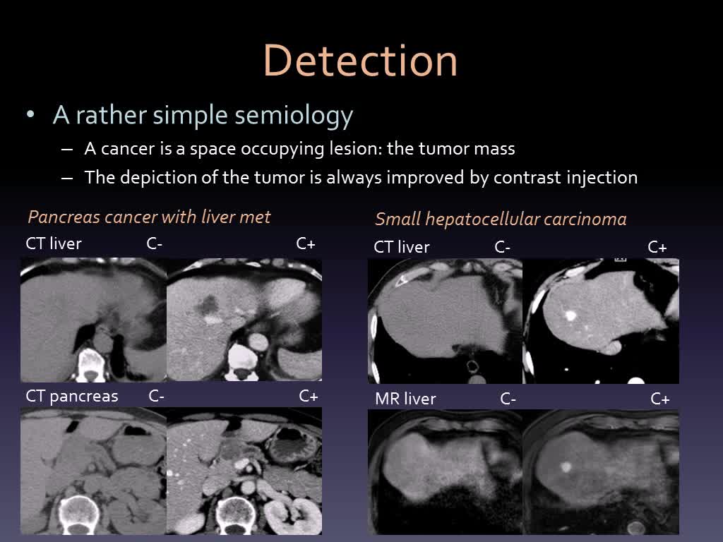 腹部肿瘤的CT和MR核内科医师应该知道什么