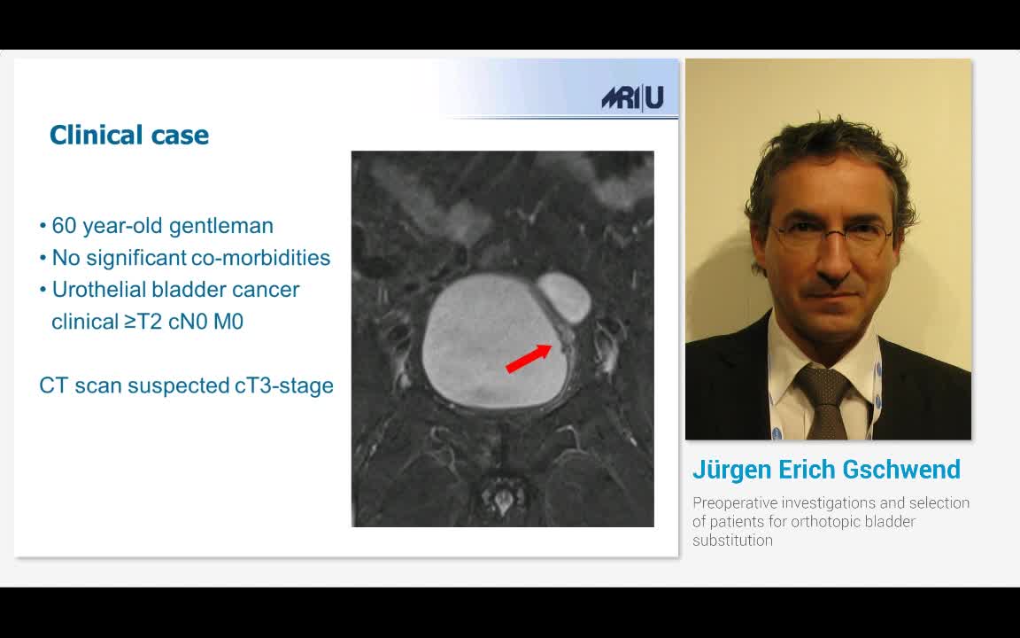 Preoperative investigations and selection of patients for..-