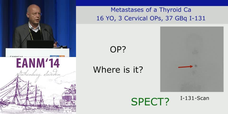 SPECT-CT在肿瘤学中的应用