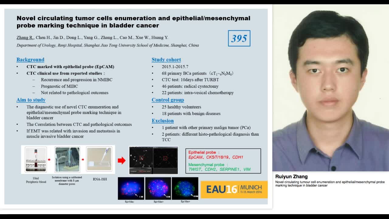 Novel circulating tumour cell enumeration and epithelial--
