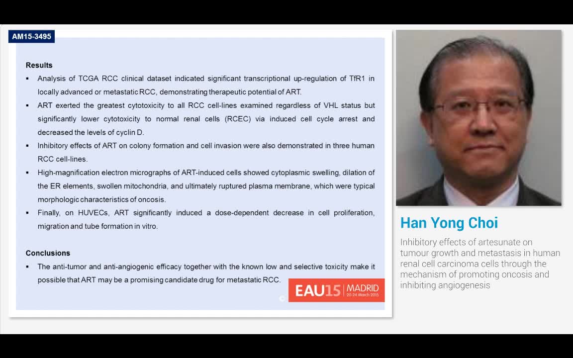 Inhibitory effects of artesunate on tumour growth and met..-