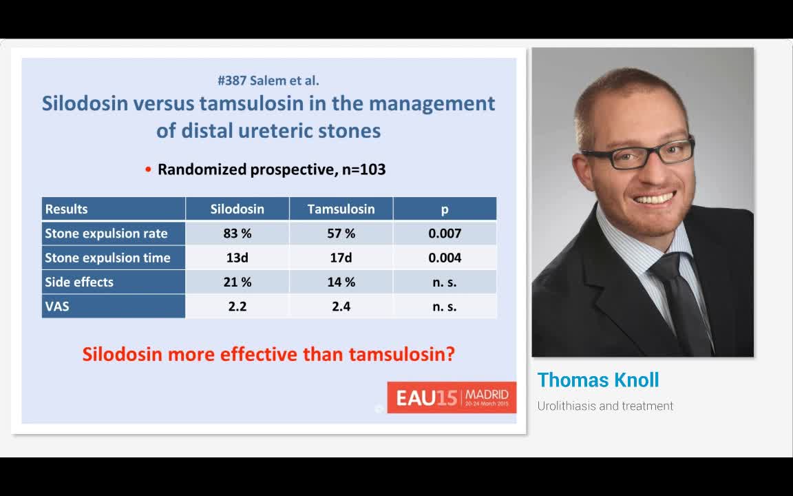 Urolithiasis and treatment