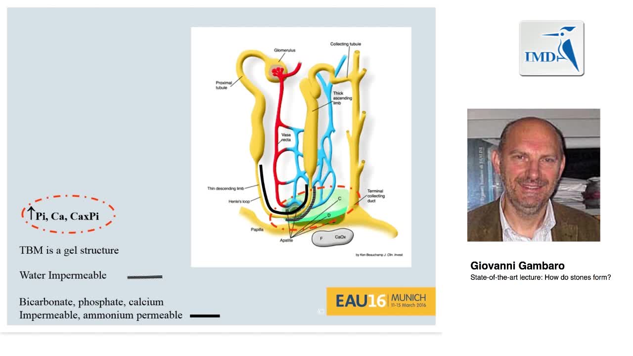 结石如何形成的（2）