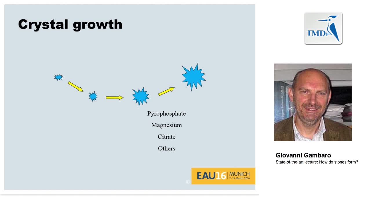 结石如何形成的（1）