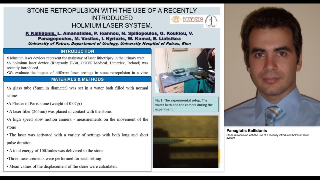 Stone retropulsion with the use of a recently introduced -