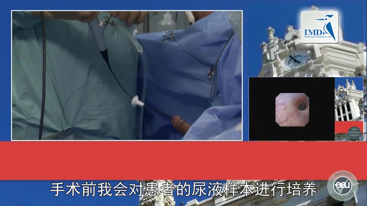 SPIES辅助逆向输尿管软镜诊断治疗上尿路结石（3）