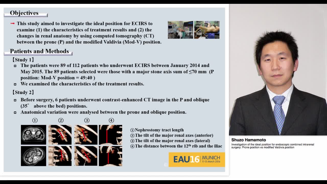 Investigation of the ideal position for endoscopic combin-