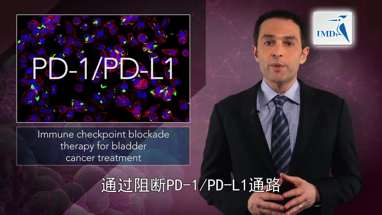 新型免疫疗法用于治疗膀胱癌前景光明