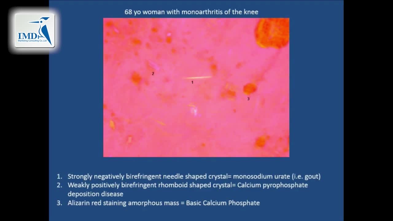 风湿病诊断和治疗方法（4）