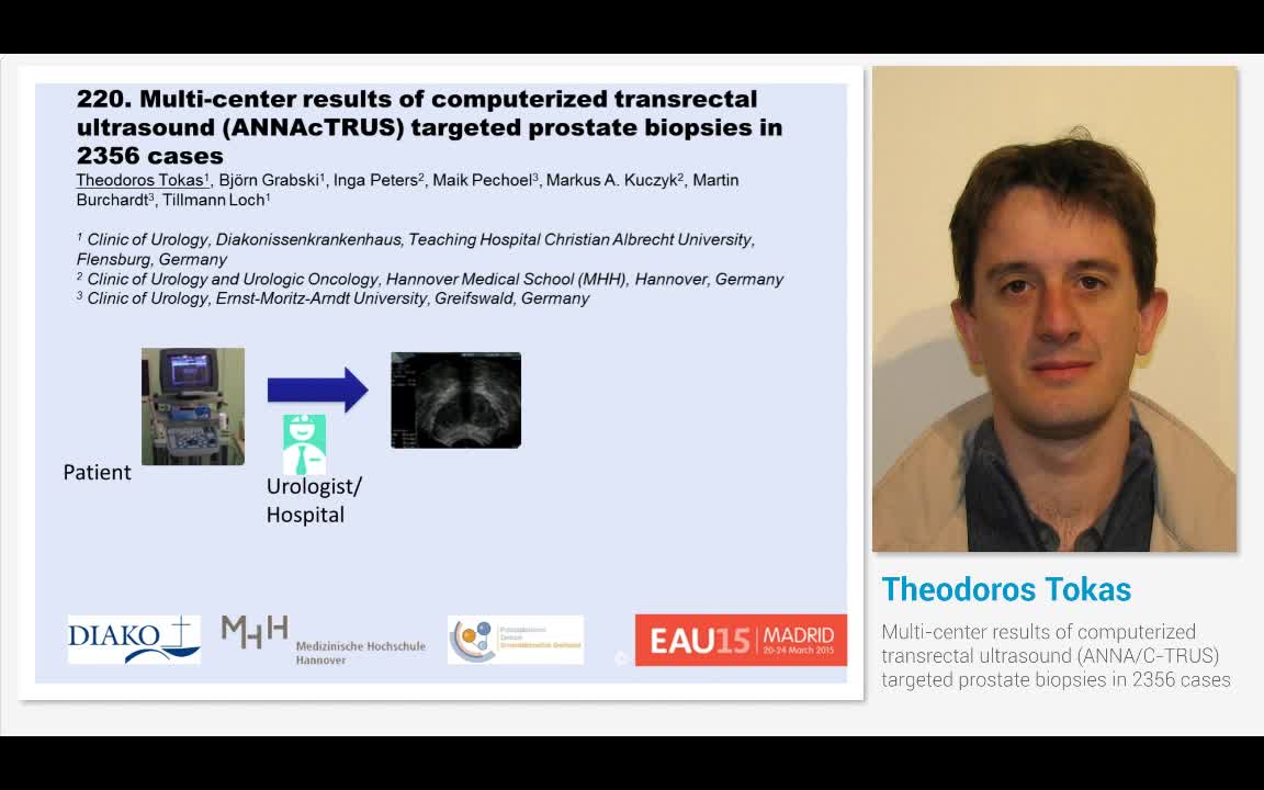 Multi-center results of computerized transrectal ultrasou..-