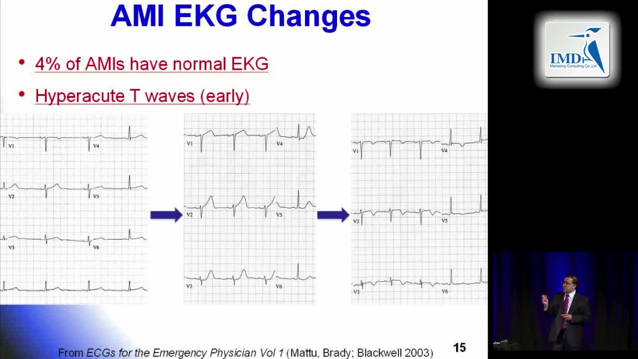 急诊医学之心脏病学（3）