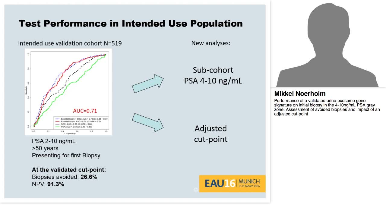 Performance of a validated urine-exosome gene signature o-