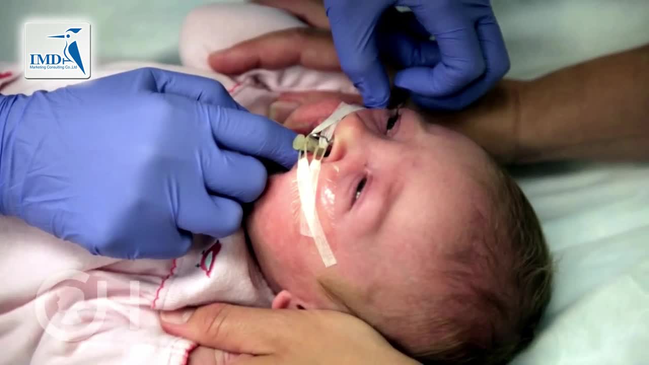 儿童唇腭裂治疗（3）