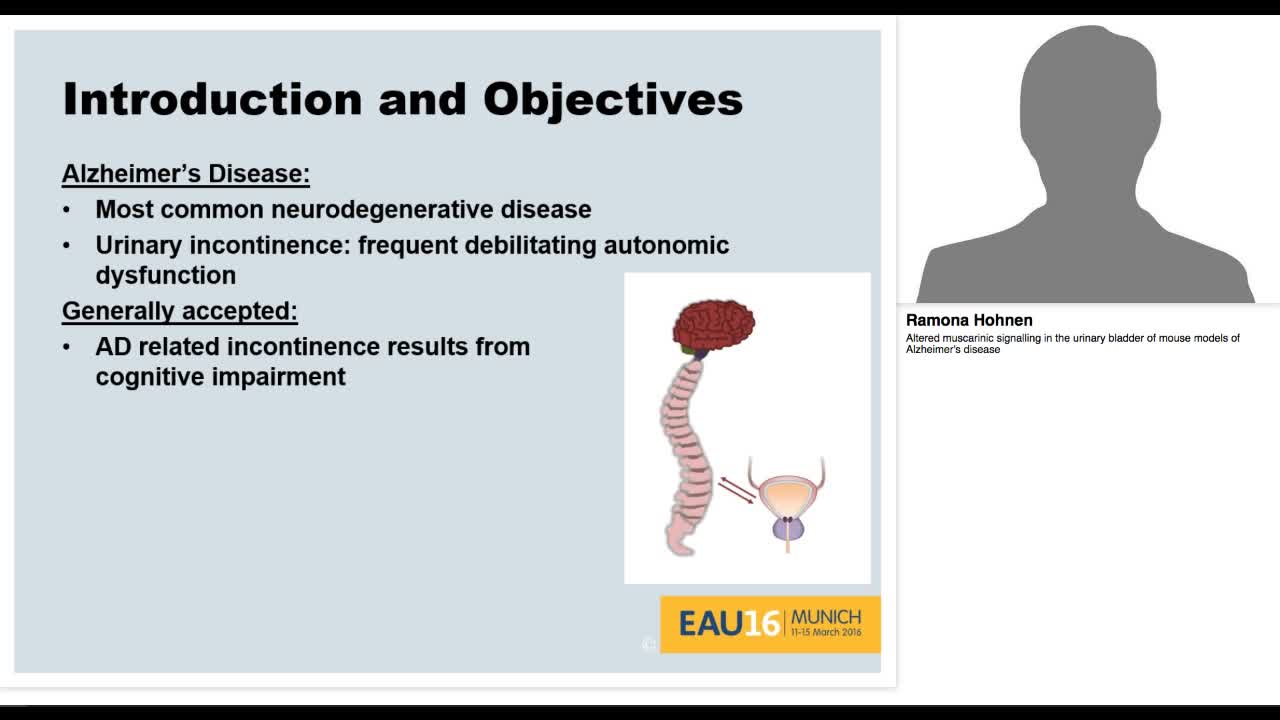 Altered muscarinic signalling in the urinary bladder of m-
