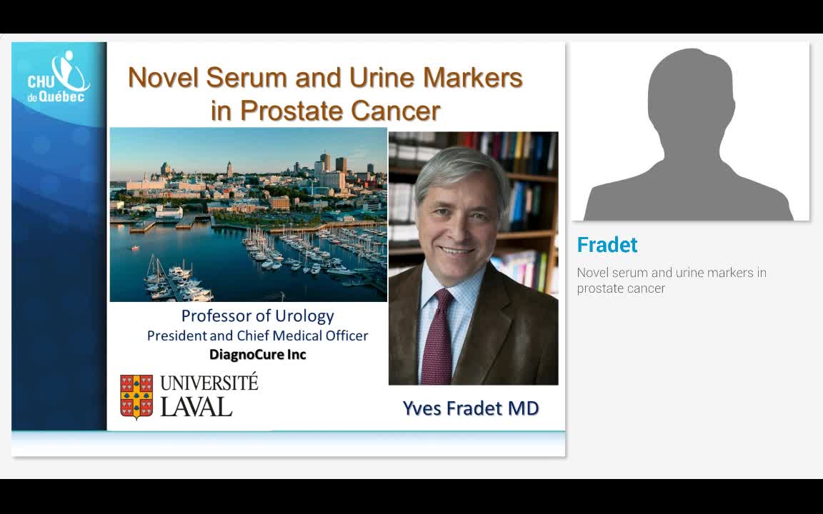 Novel serum and urine markers in prostate cancer
