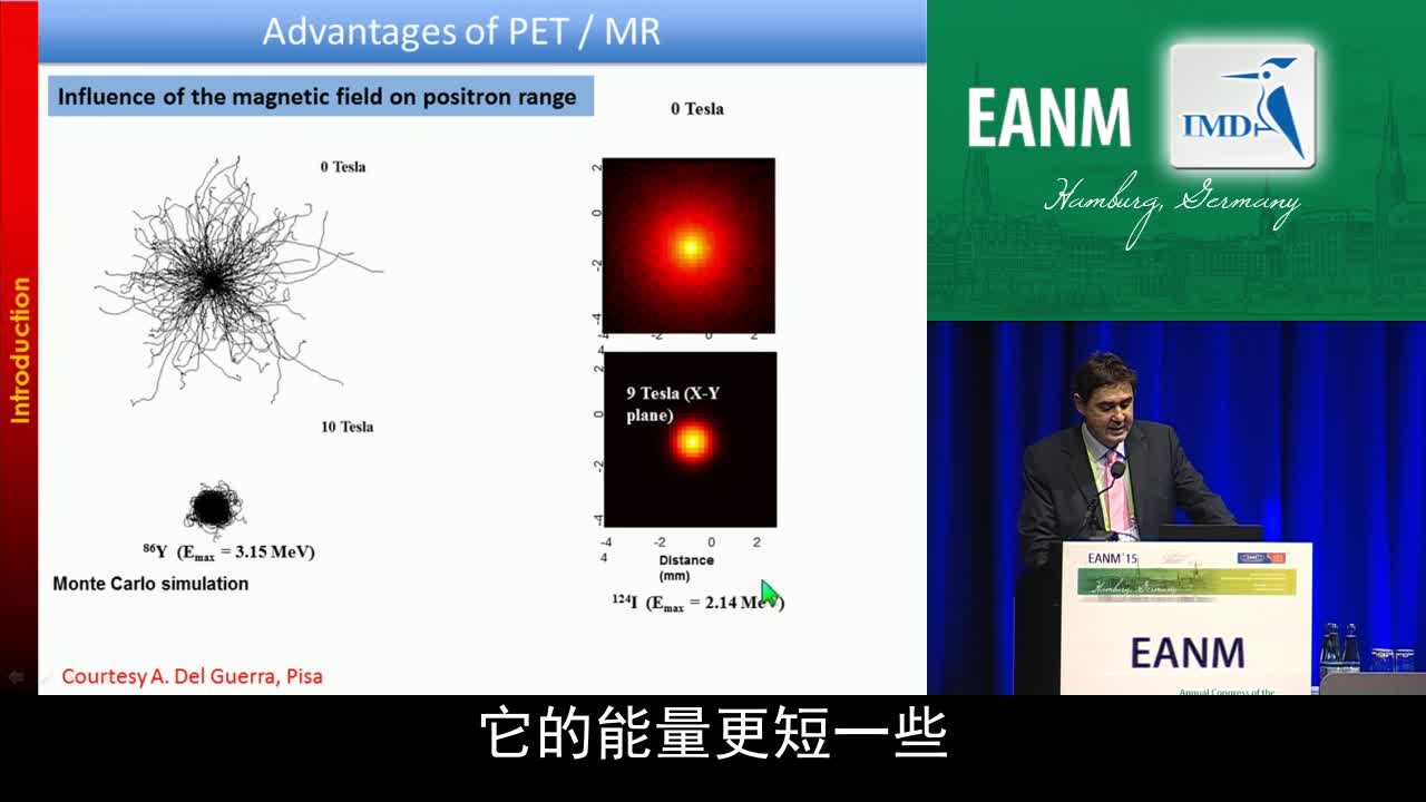 PET和MR 在软组织肉瘤诊断治疗中的作用（2）