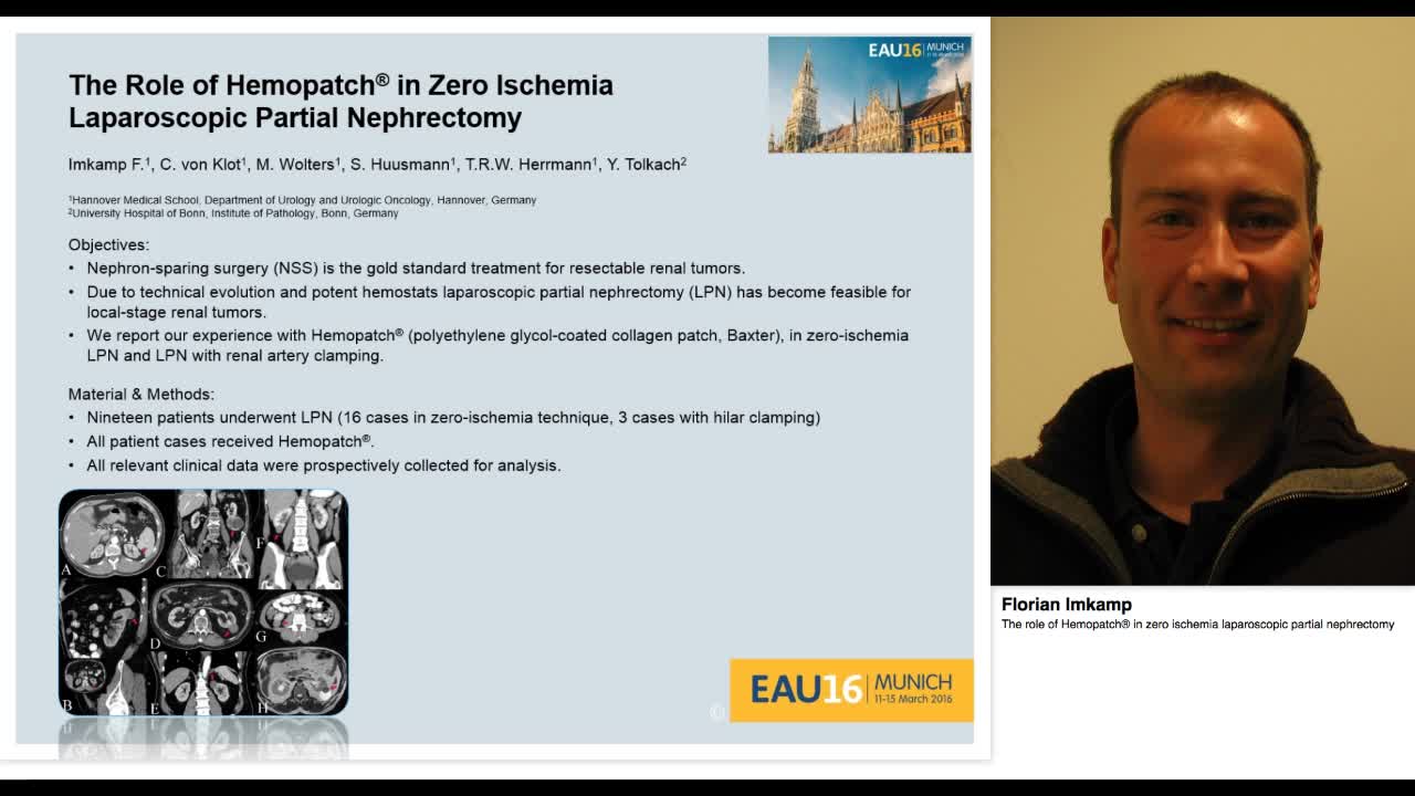 The role of Hemopatch\u00AE in zero ischemia laparoscopic part-