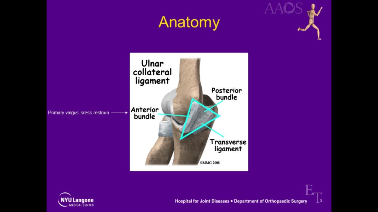 Ulnar Collateral LigamentReconstruction&mdash;ModifiedJobe Approach using Docking Technique