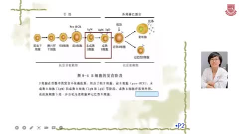 郭海飞-多发性骨髓瘤