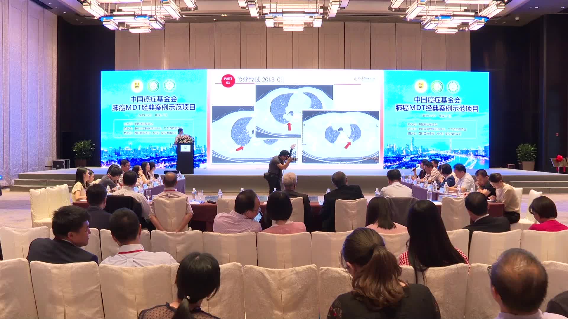 双侧肺部多发肿瘤治疗方法的专家意见