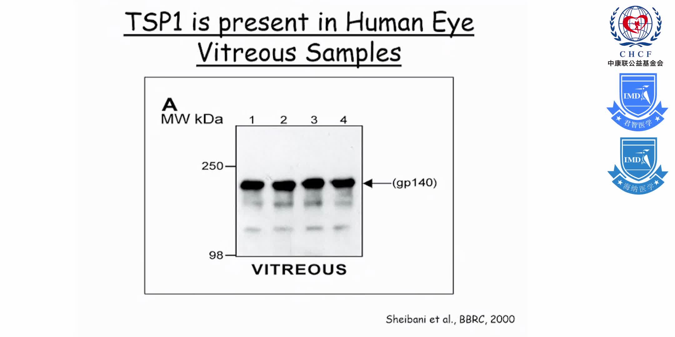 增生型糖尿病视网膜病变 1-7