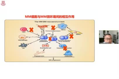 房佰俊-首次复发难治性多发性骨髓瘤的治疗探索