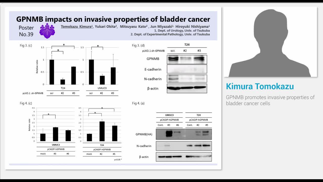 GPNMB promotes invasive properties of bladder cancer cells