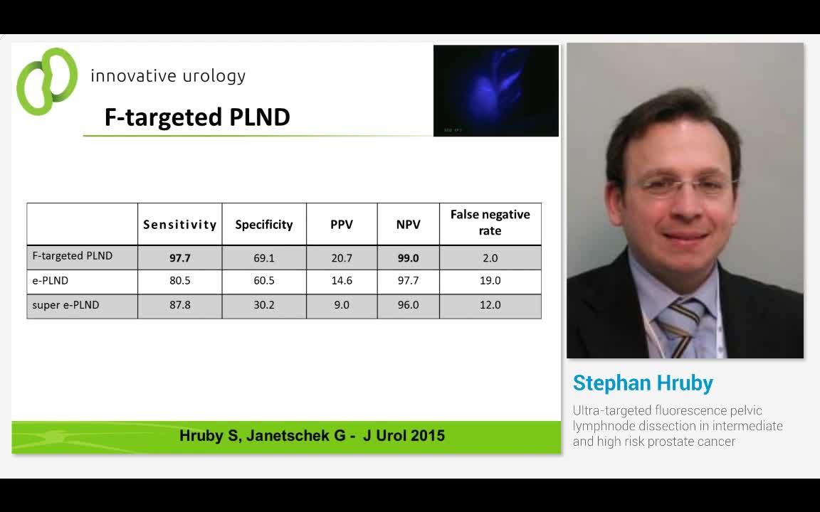 Ultra-targeted fluorescence pelvic lymphnode dissection i..-