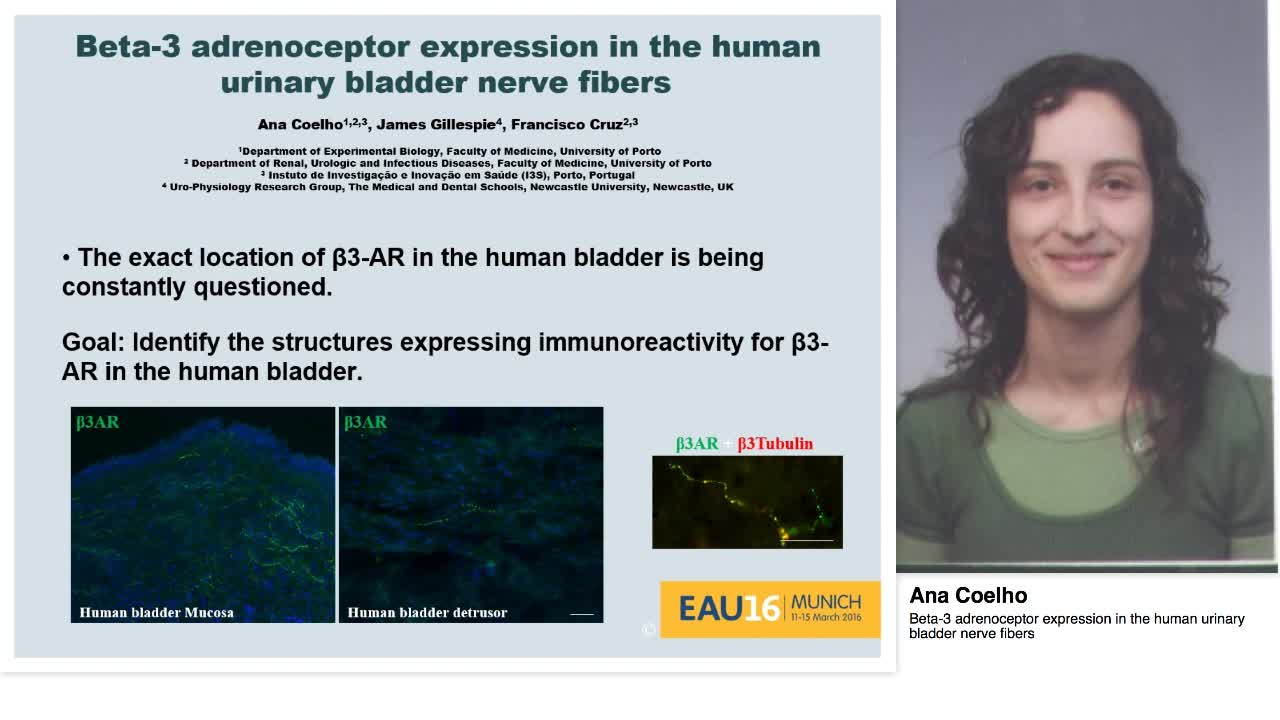Beta-3 adrenoceptor expression in the human urinary bladd-