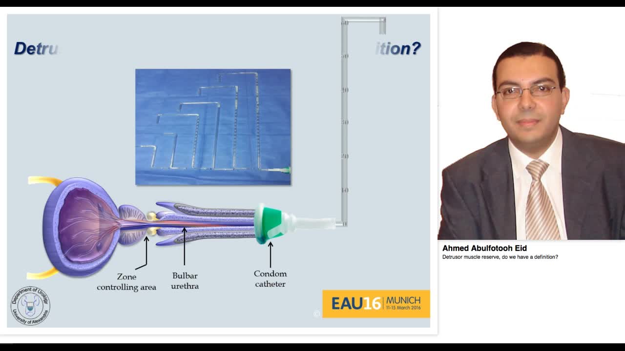 Detrusor muscle reserve, do we have a definition.