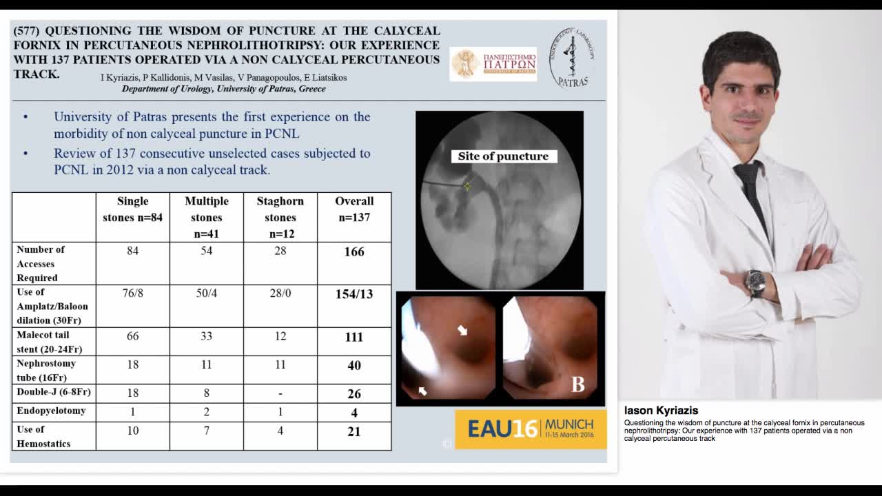 Questioning the wisdom of puncture at the calyceal fornix-