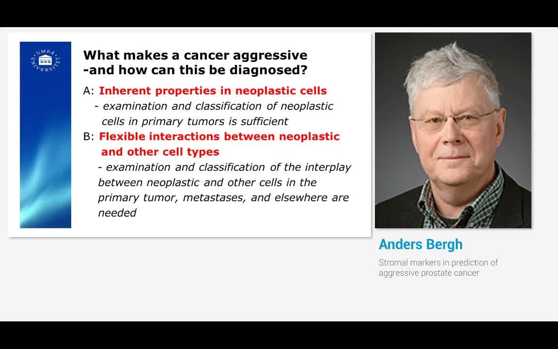 Stromal markers in prediction of aggressive prostate cancer