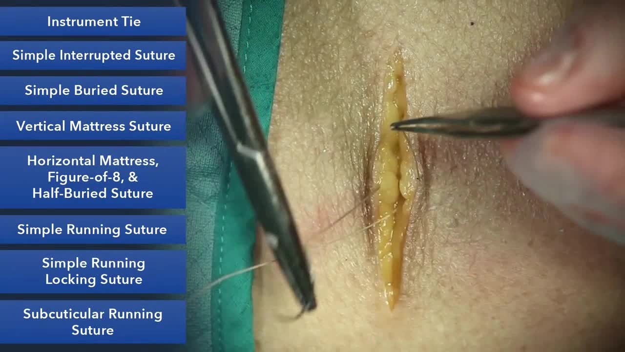 杜克缝合手术技能课程（2）