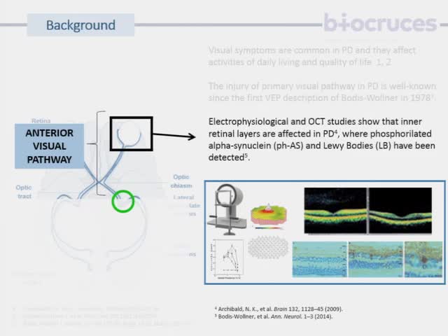 Retinal and visual cortex damage and higher order visual dysfunction in carriers of E46K mutation of alpha-synuclein gene