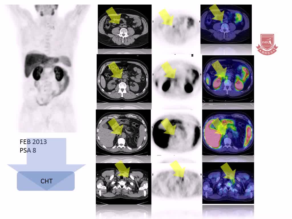 FDG之外的显踪剂2