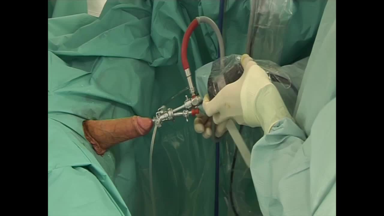 Percutaneous micronephrolithotomy, Surgical technique