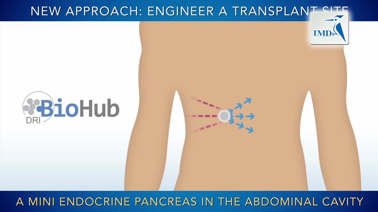 生物工程---&ldquo;迷你胰腺&rdquo;分泌胰岛素