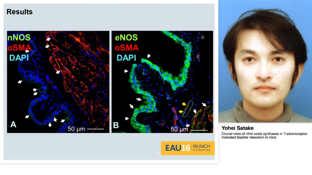 Crucial roles of nitric oxide synthases in .-adrenoceptor-