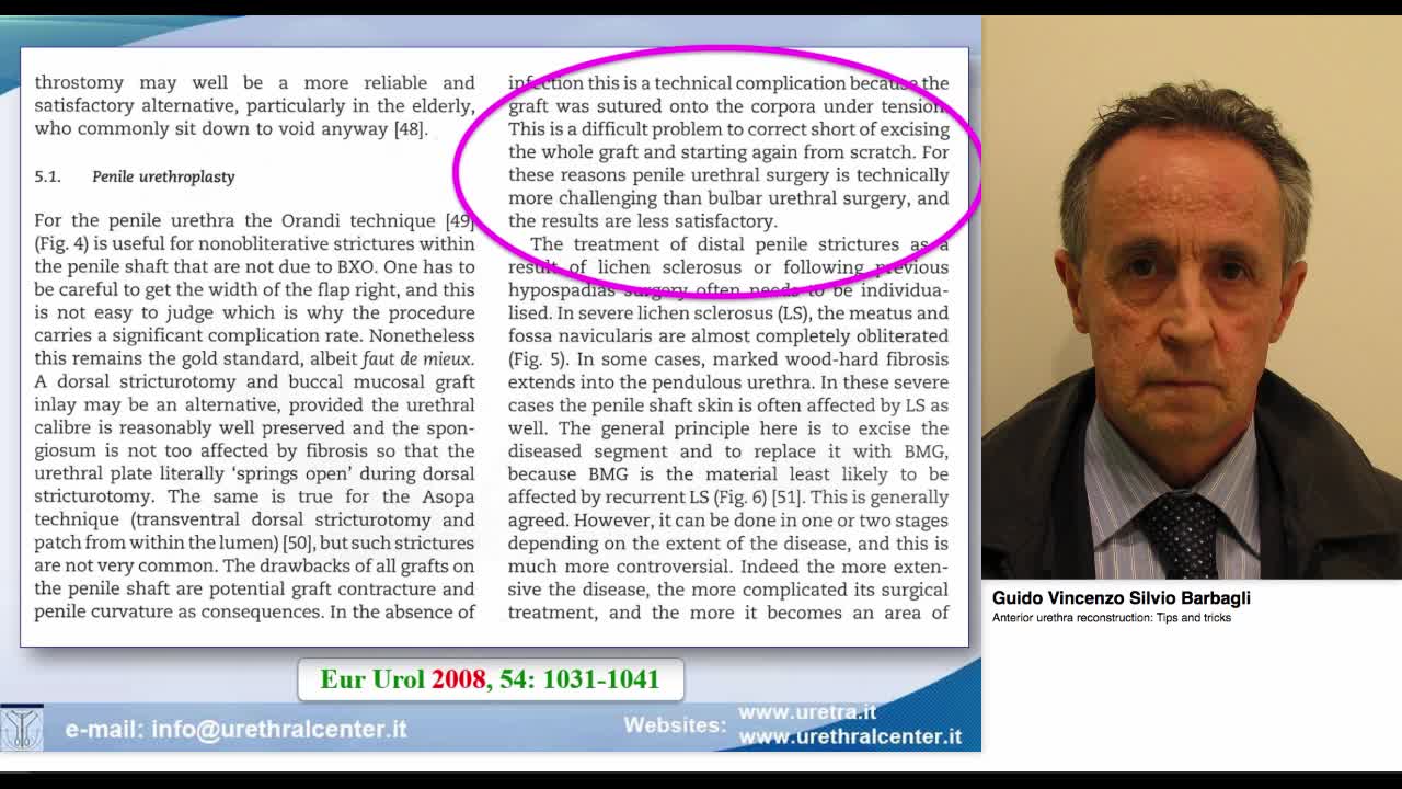 Anterior urethra reconstruction, Tips and tricks