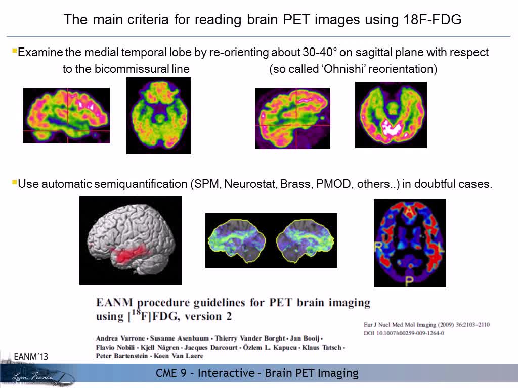 FDG PET与前驱AD的其他生物标志物