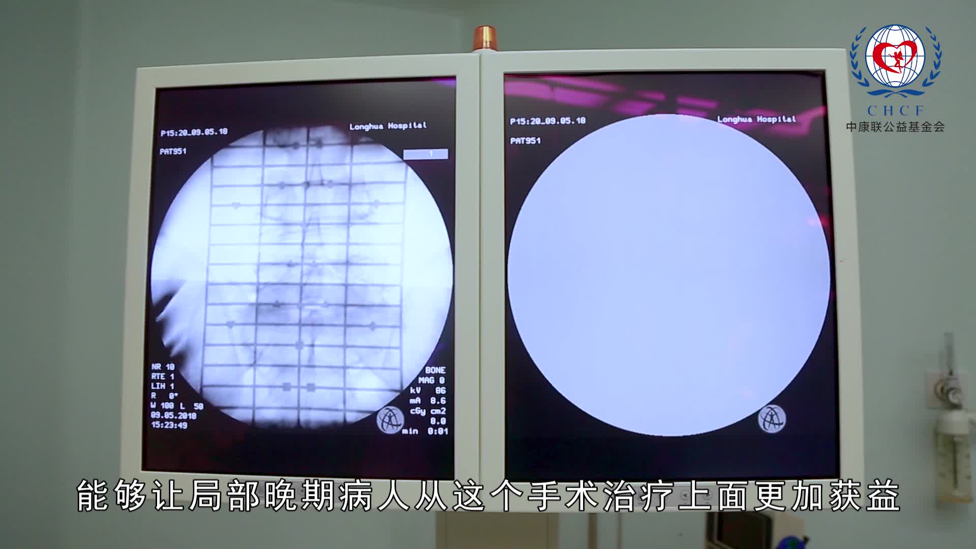 葛棣：浅谈肺癌的新辅助免疫治疗