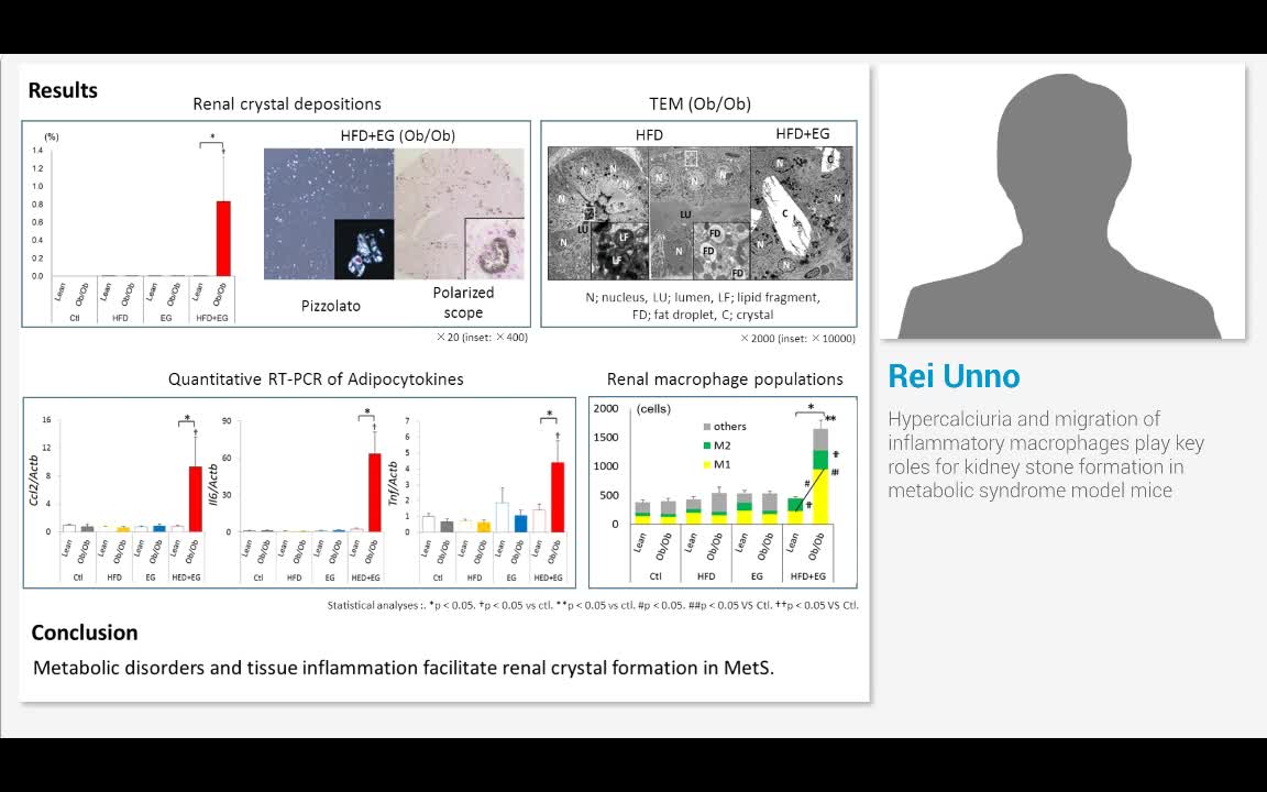 Hypercalciuria and migration of inflammatory macrophages ..-