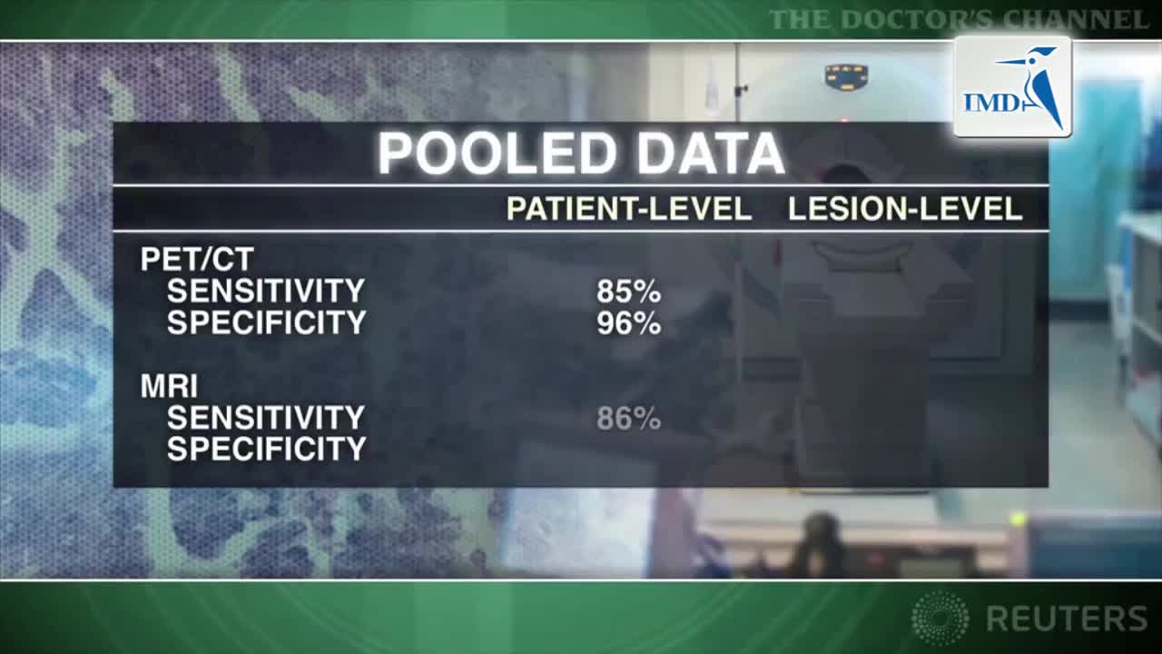 MRI与PETCT在肿瘤转移检测方面具有可比性