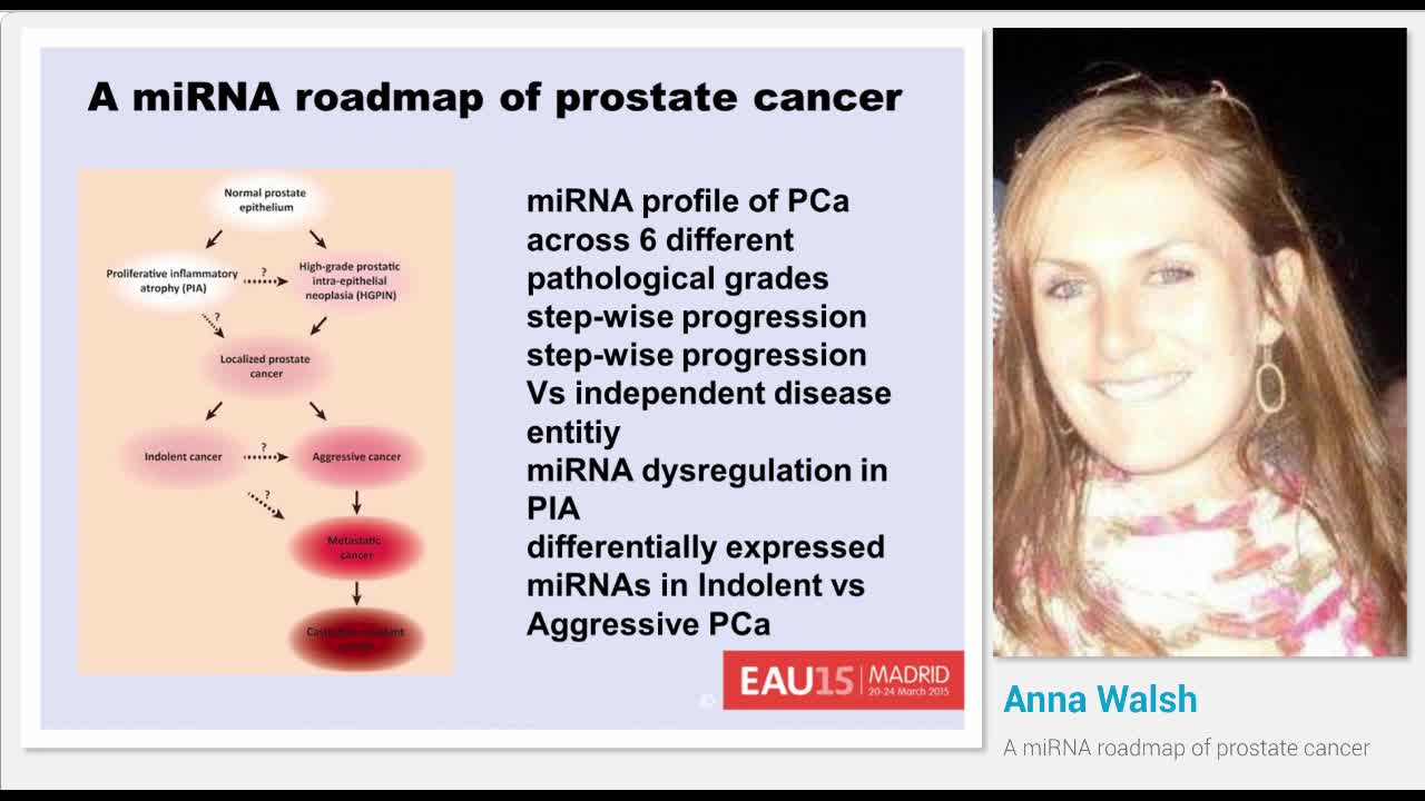 A miRNA roadmap of prostate cancer
