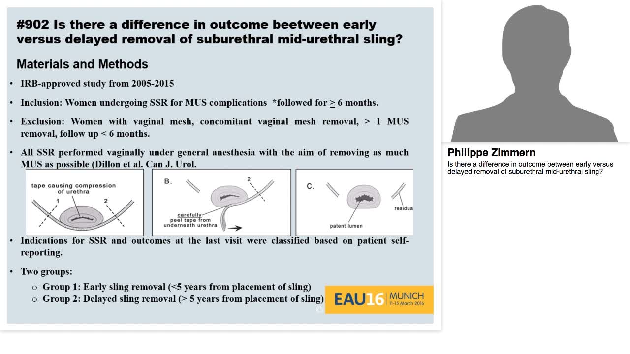 Is there a difference in outcome between early versus del-