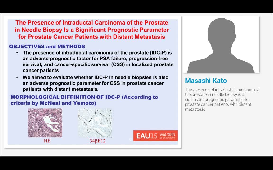 The presence of intraductal carcinoma of the prostate in ..-